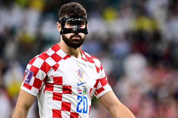 พี่เสือรายล่าสนคว้า ‘กวาร์ดิโอล’ คุมหลังบ้าน