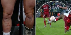 เห็นแผลมั้ย? ‘ราบิโอต์’ โอดเปาควรให้จุดโทษ ‘ม้าลาย’