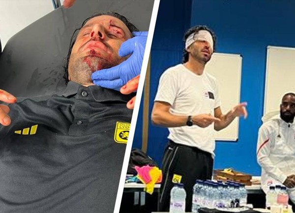 อย่างเถื่อน! ‘กรอสโซ่’ หน้าแหกถูกแฟนมาร์กเซยปาหินใส่รถบัส