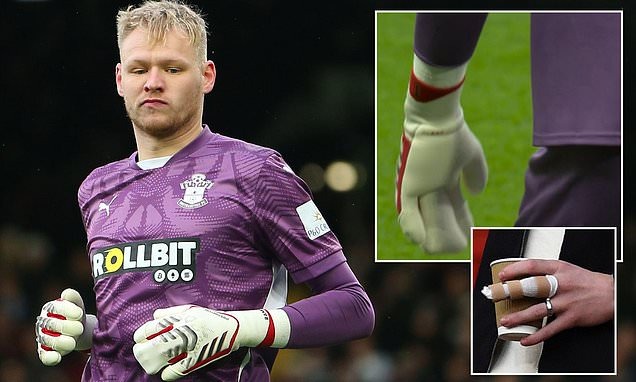 ‘แรมส์เดล’ สวมถุงมือพิเศษหลังฟื้นจากนิ้วหัก