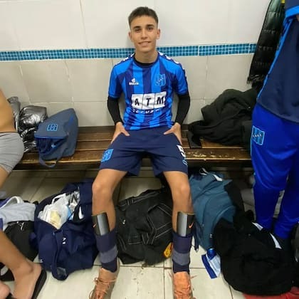 เศร้า…’ดาวรุ่งฟ้าขาว’ ผ่าเข่าเสียชีวิต