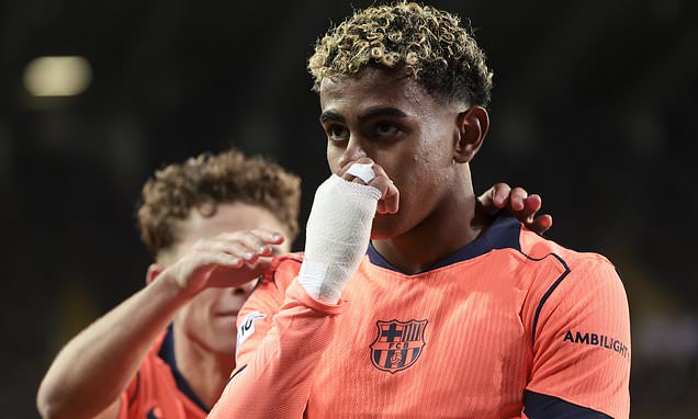 ไม่หายสักที…บาร์ซ่าเรียกหมอรักษา ‘หัวหน่าว’ ยามาล